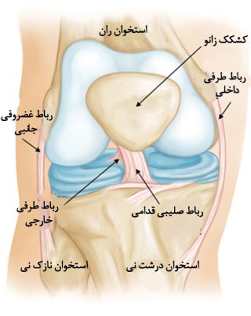 آسیب ACL