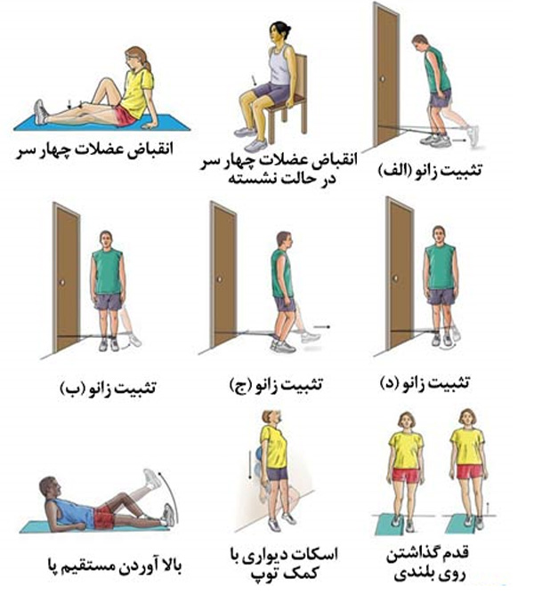آسیب ACL